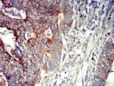 Валидация AntibodySystem RHH08402