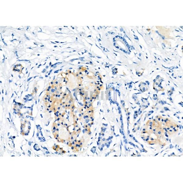 Валидация Affinity DF4892 - 16687