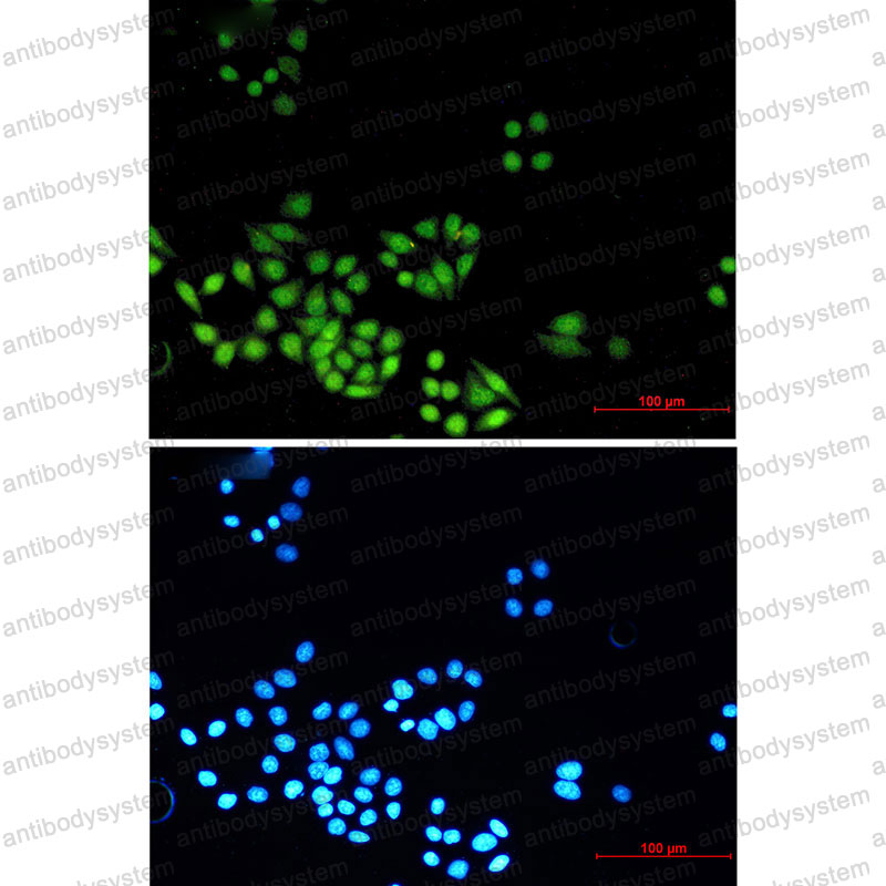 Валидация IF - AntibodySystem RHK44601