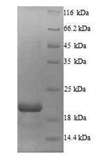 SDS-PAGE