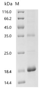 SDS-PAGE