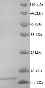 SDS-PAGE