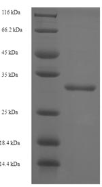 SDS-PAGE