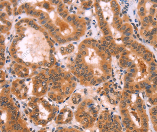 Иммуногистохимия, NCEH1, ткань мозга человека