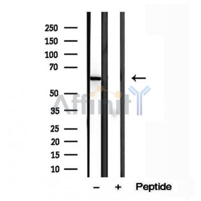 Валидация Affinity DF12016 - 6027