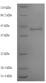 SDS-PAGE