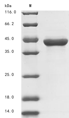 SDS-PAGE