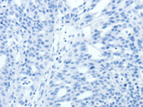 Валидация AssayVector ARM1599(1672)