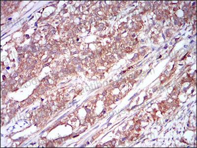 Валидация AntibodySystem RHC25203