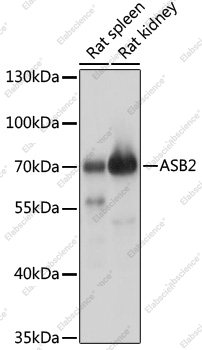 Вестерн-блоттинг, ASB2, различные клеточные линии