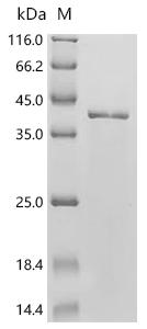 SDS-PAGE