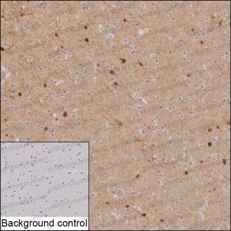 Валидация AntibodySystem RHA31301