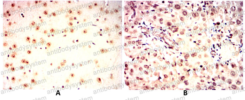 Валидация AntibodySystem RHG08704 (2833)