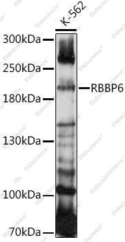 Вестерн-блоттинг, RBBP6, клетки K-562