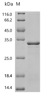SDS-PAGE