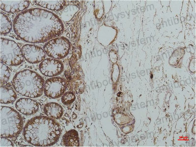 Валидация AntibodySystem RHC84903 (1118)