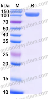 AHJ40403, SDS-PAGE