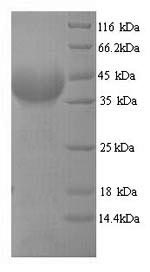 SDS-PAGE