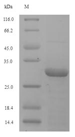 SDS-PAGE