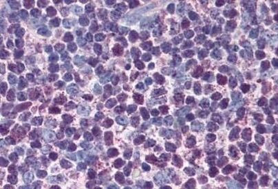 Валидация AssayVector ARM1238(622)