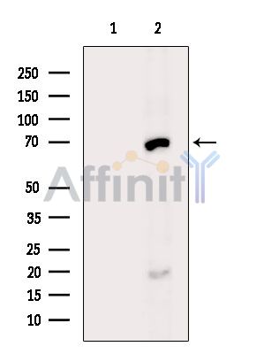 Валидация Affinity DF13956 - 9704