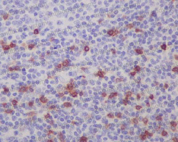 Валидация AntibodySystem RHE22901