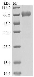 SDS-PAGE