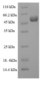 SDS-PAGE