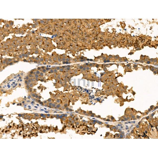 Валидация Affinity AF5474 - 3141