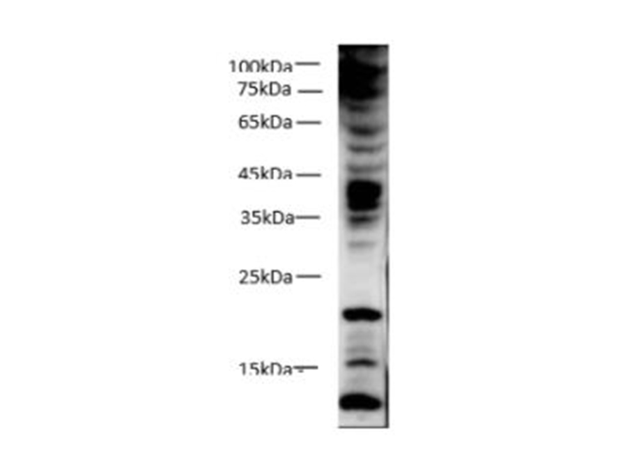 Вестерн-блоттинг, Phospho Tyrosine, клетки 293T