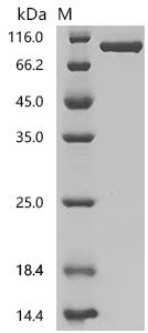 SDS-PAGE