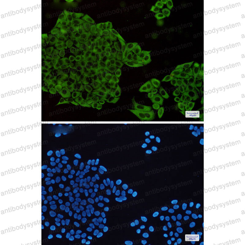 Валидация IF - AntibodySystem RHF95509