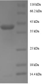 SDS-PAGE