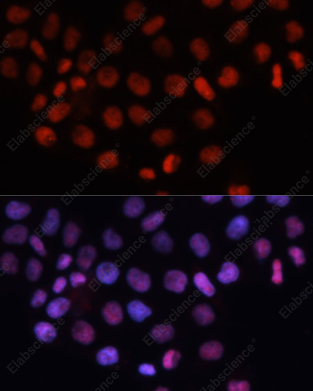 Иммунофлуоресценция, RCC1, клетки HeLa