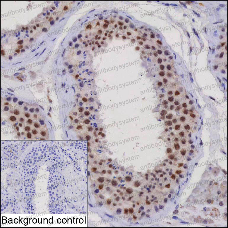 Валидация AntibodySystem RHH17302