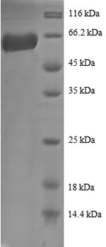 SDS-PAGE