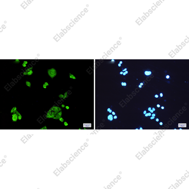 Иммунофлуоресценция, PGD, клетки HeLa