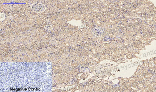 Валидация AntibodySystem RHC21301 (790)