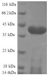 SDS-PAGE