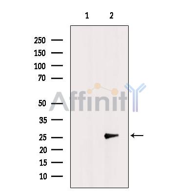 Валидация Affinity DF3944 - 15143
