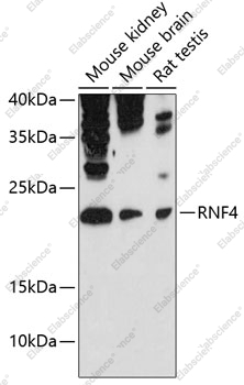 Вестерн-блоттинг, RNF4, различные клеточные линии