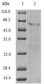 SDS-PAGE