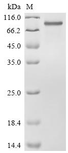 SDS-PAGE