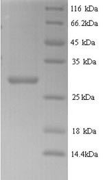 SDS-PAGE