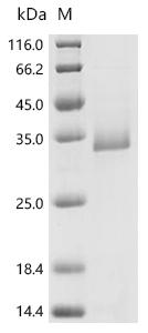 SDS-PAGE
