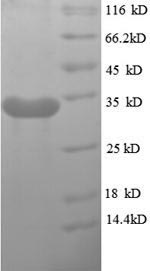 SDS-PAGE