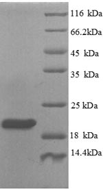 SDS-PAGE