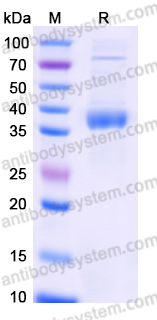 EHJ46003, SDS-PAGE