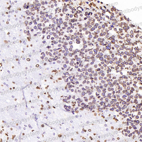 Валидация AntibodySystem RHD40901 (1568)