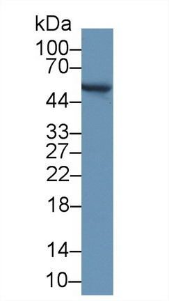 14155